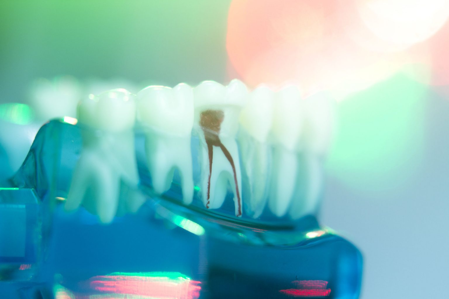 Endodontic Treatment Endodontic & Implant Center